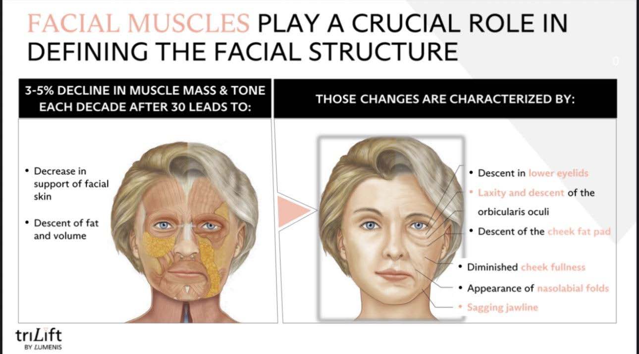 LIVE AUCTION - Holiday Radiance by Bliss