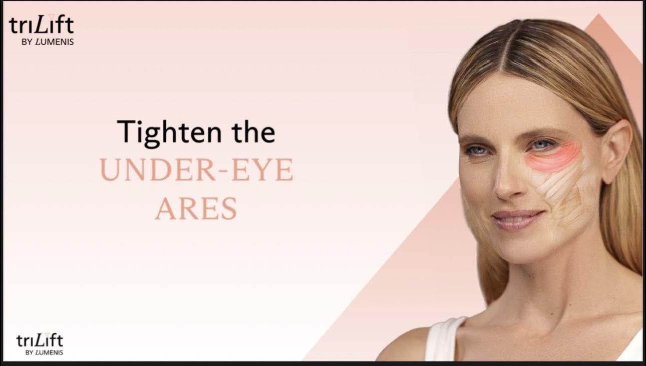 LIVE AUCTION - Holiday Radiance by Bliss