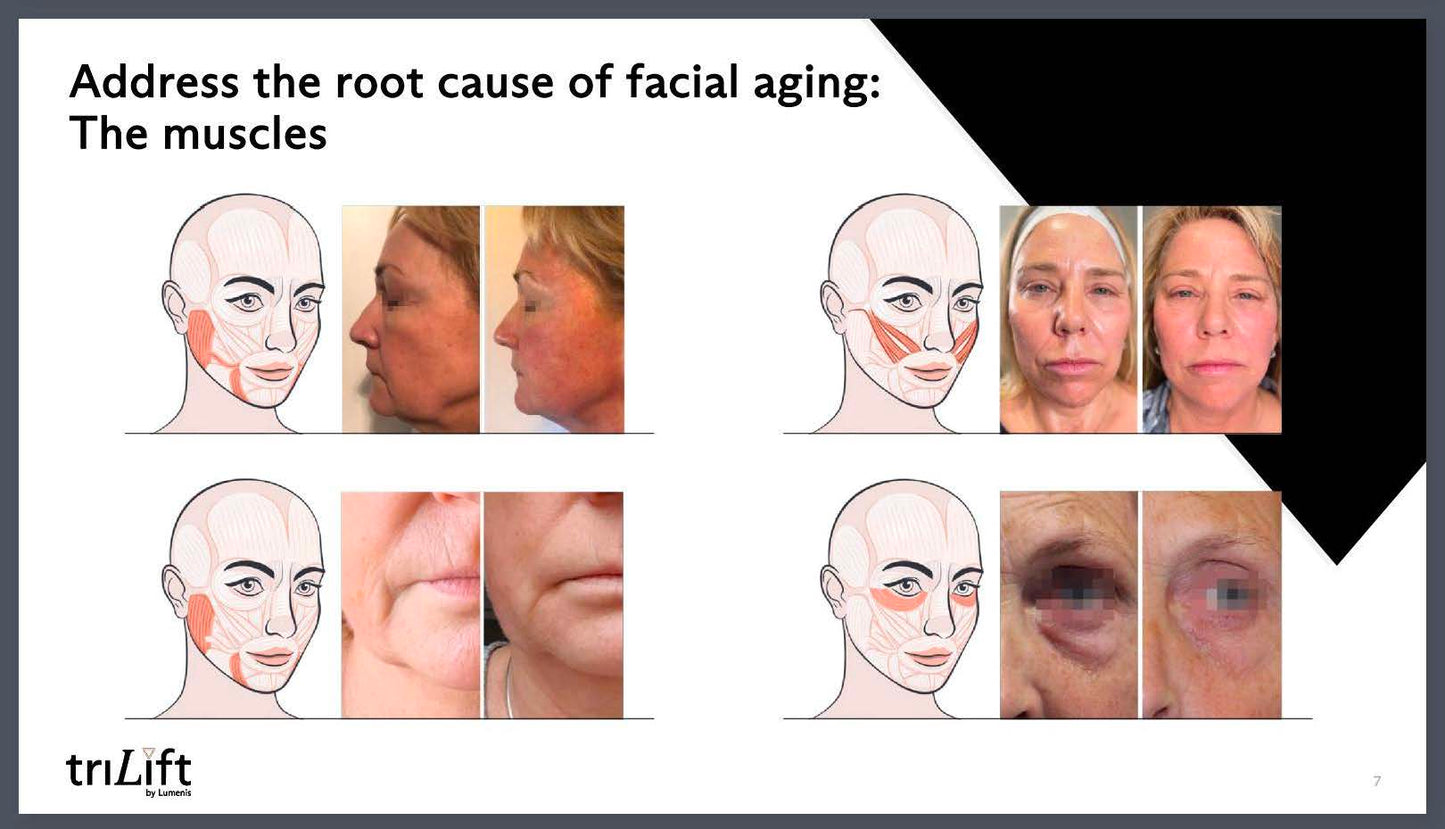 LIVE AUCTION - Holiday Radiance by Bliss