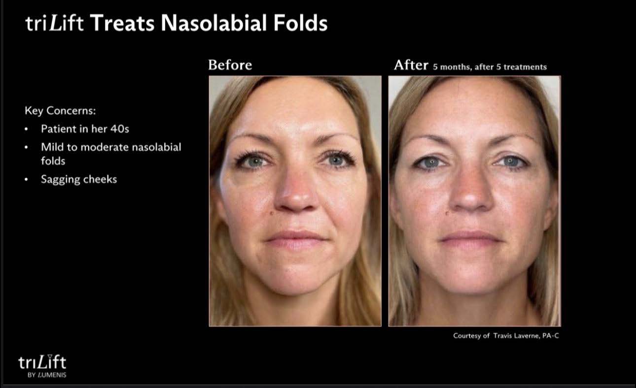 LIVE AUCTION - Holiday Radiance by Bliss