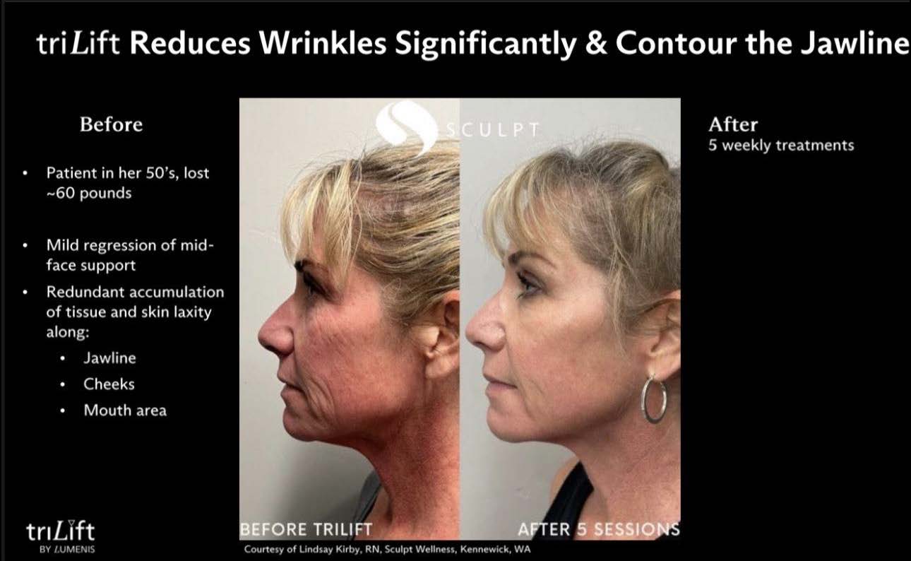 LIVE AUCTION - Holiday Radiance by Bliss