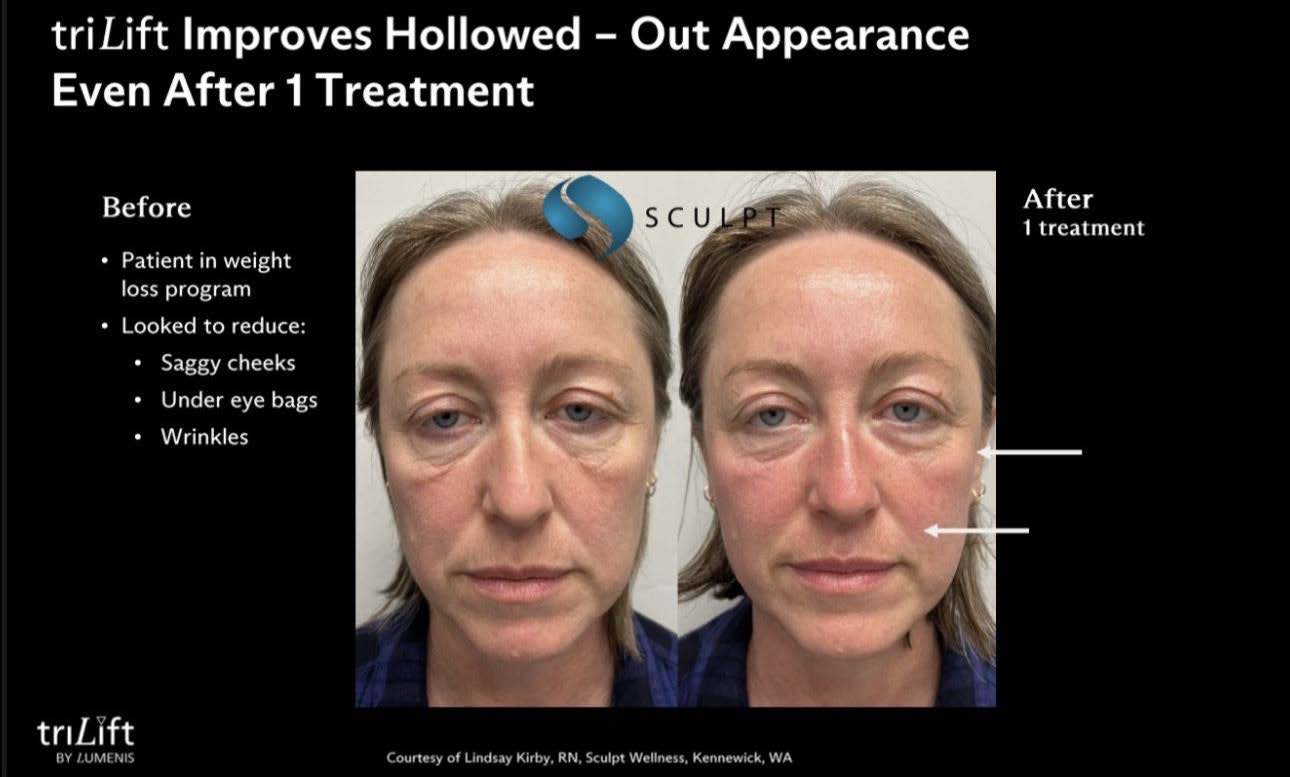 LIVE AUCTION - Holiday Radiance by Bliss