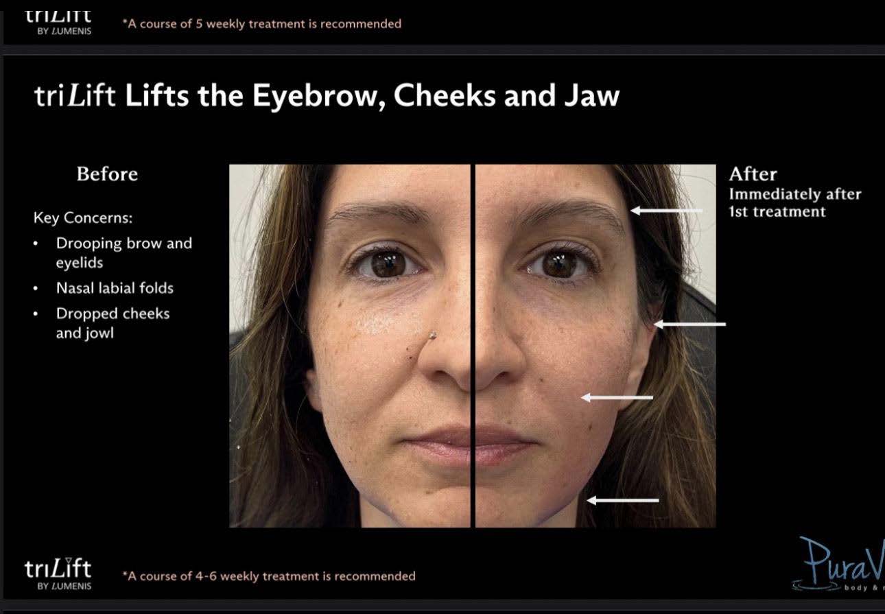 LIVE AUCTION - Holiday Radiance by Bliss