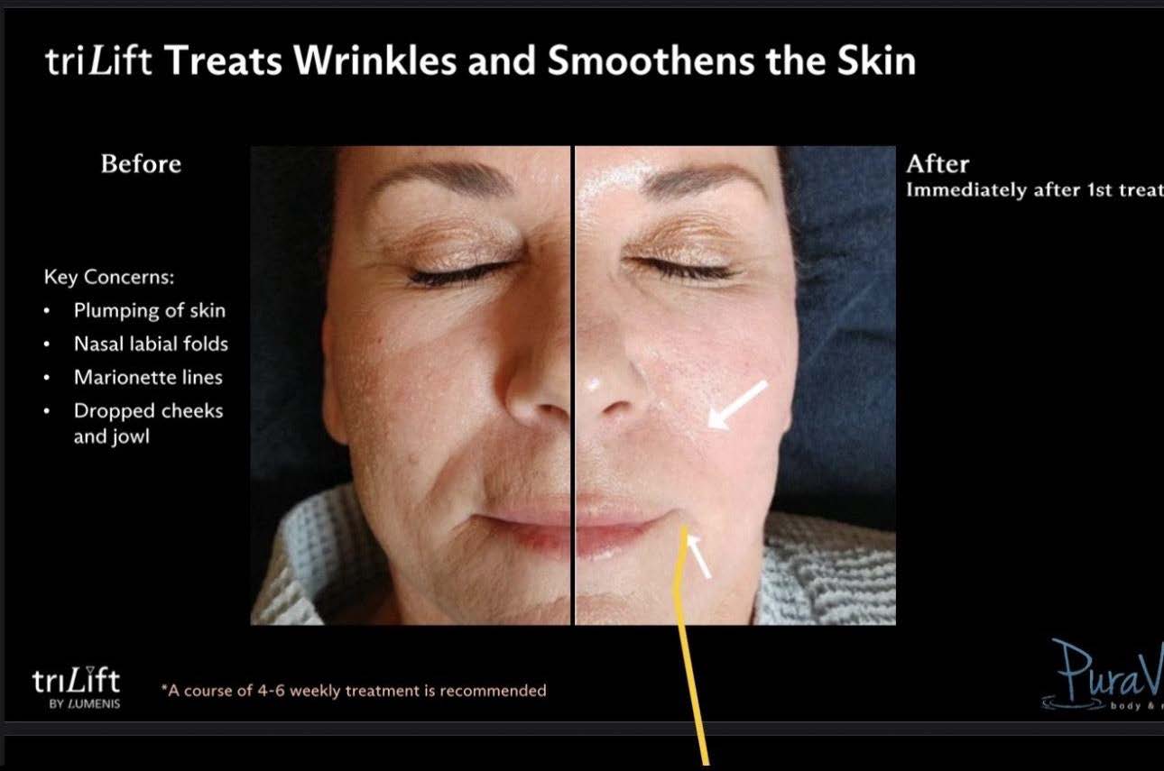 LIVE AUCTION - Holiday Radiance by Bliss