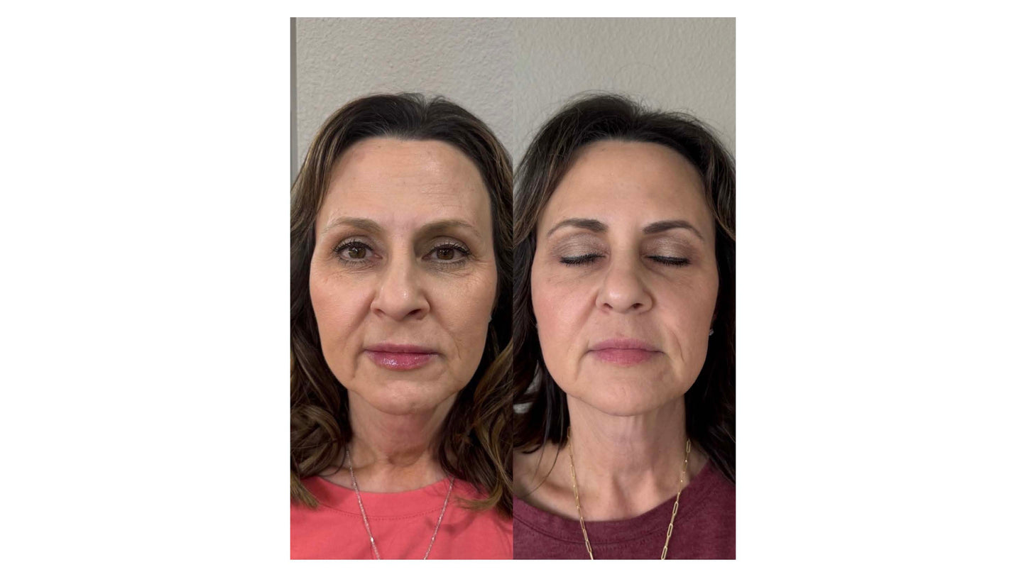 LIVE AUCTION - Holiday Radiance by Bliss