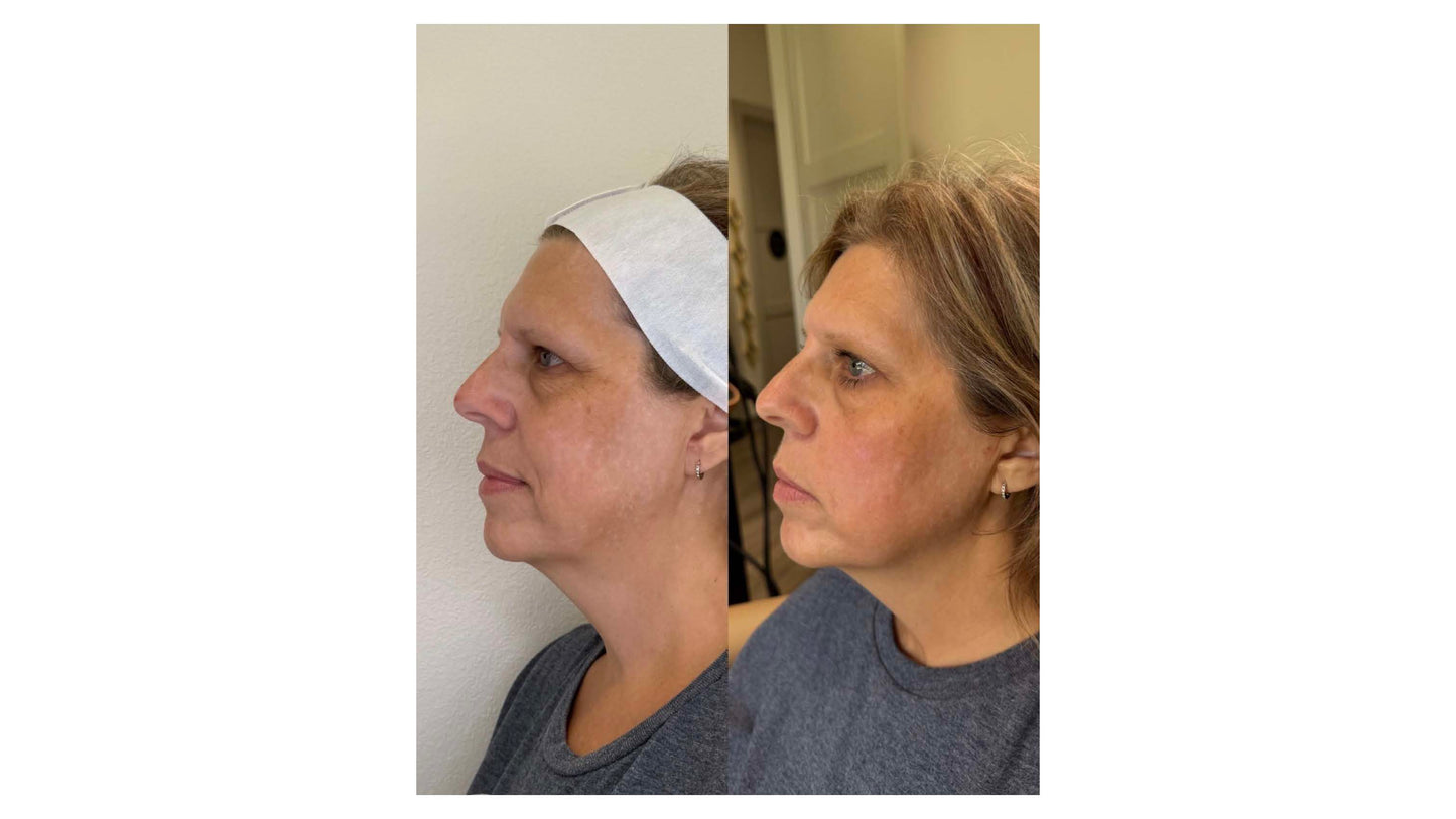 LIVE AUCTION - Holiday Radiance by Bliss